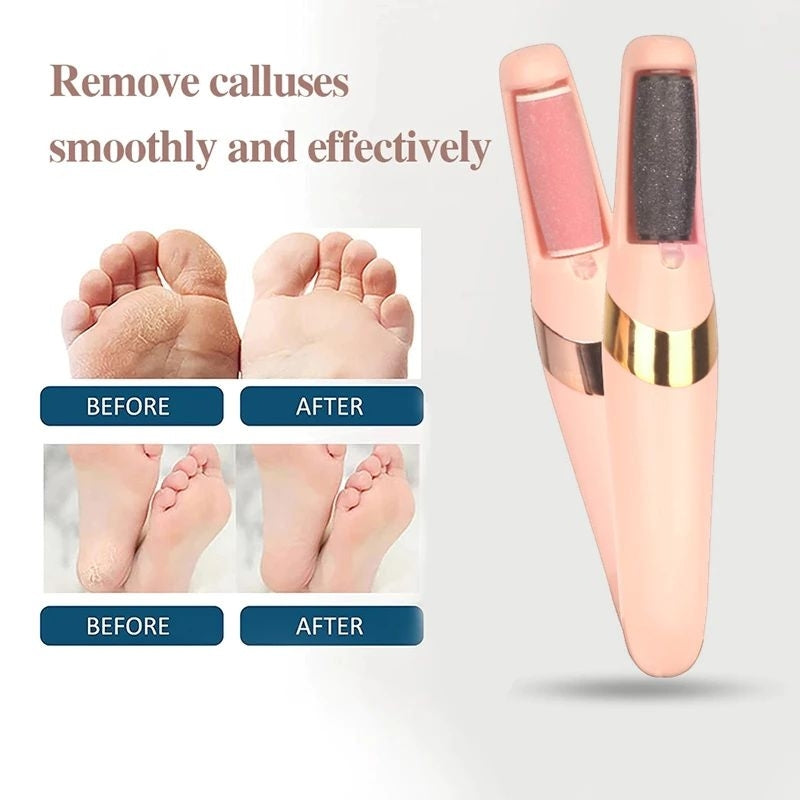 Electric Fast Callus Remover  ||  Portable Electric Foot Grinder