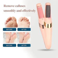 Thumbnail for Electric Fast Callus Remover  ||  Portable Electric Foot Grinder